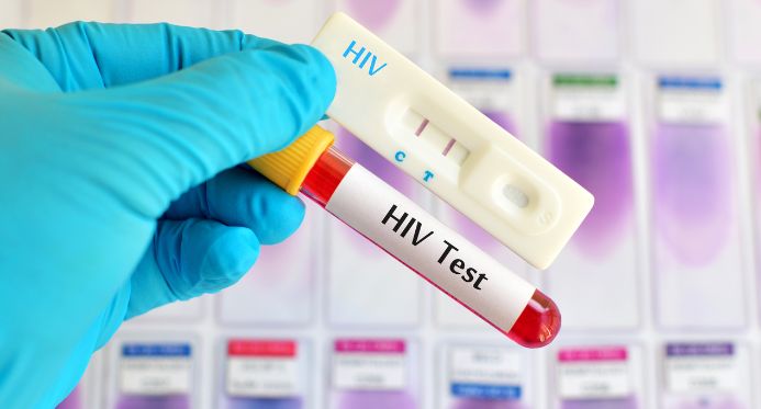 ES recebe R$ 5,9 milhões para ações contra HIV/aids, tuberculose e hepatites virais