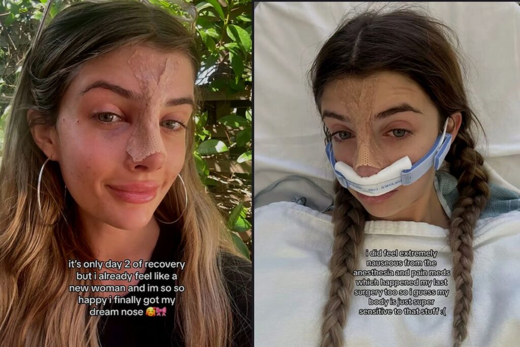 Filha de Charlie Sheen está feliz com sua segunda cirurgia estética