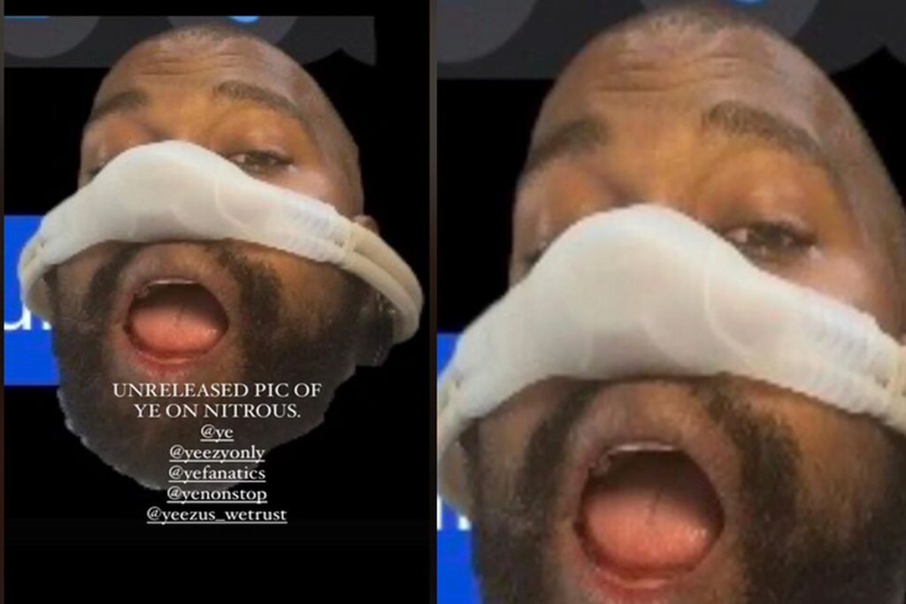 Kanye West está viciado em gás nitroso, diz seu ex-chefe