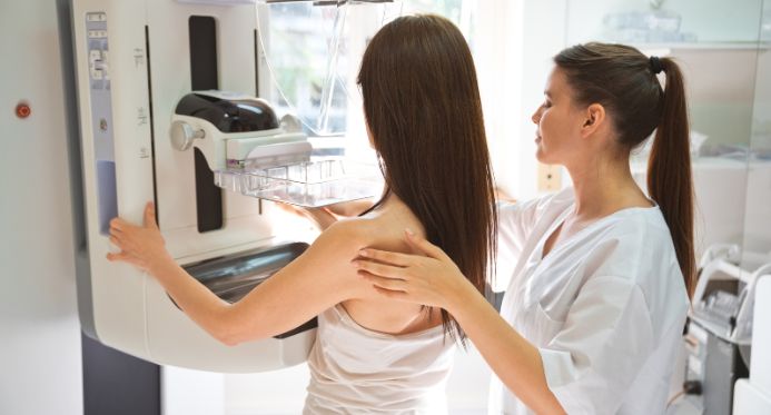 Espírito Santo amplia acesso à mamografia para mulheres a partir dos 40 anos