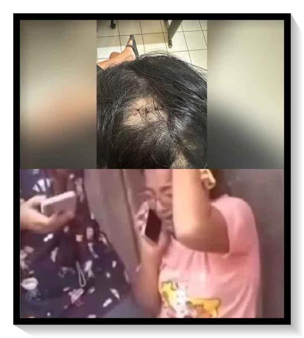 Imagens: enfermeira é atingida com golpe de facão na cabeça em Terra Indígena no Pará