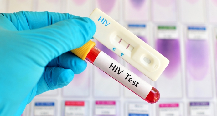 Aids: Brasil tem alta de casos, mas menor mortalidade desde 2013