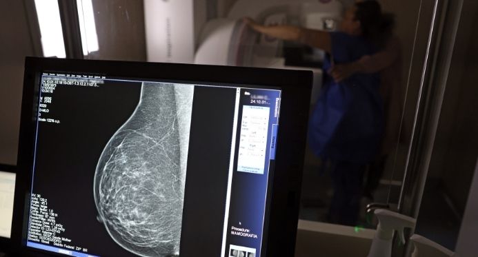 Entidades médicas defendem mamografia a partir dos 40 anos e pressionam ANS