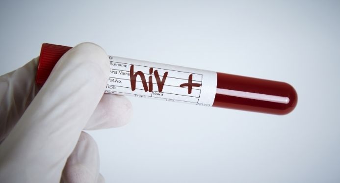 Brasil reduz transmissão de HIV e pede certificação internacional