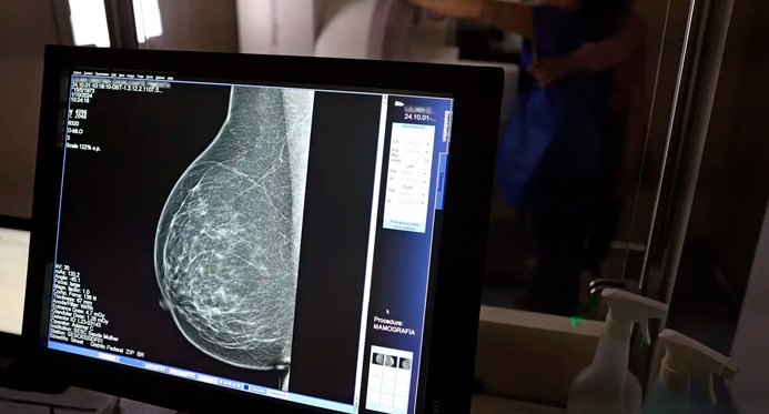 Ministério da Saúde passa a recomendar mamografia a partir dos 40 anos