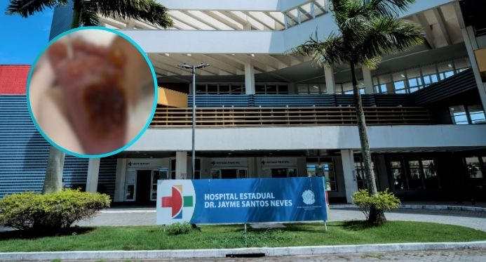 Técnica de enfermagem que queimou pé de bebê no ES é demitida após auditoria