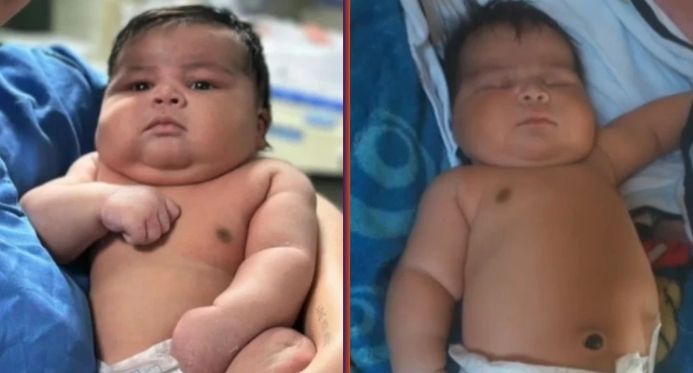 Sesa investiga parto de bebê de 6,5 kg que feriu mãe e recém-nascido em Colatina
