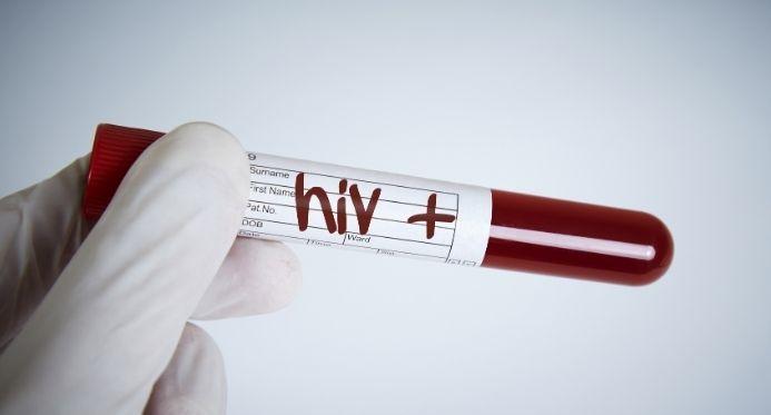 Dezembro Vermelho: Espírito Santo tem mais de 20 mil pessoas em tratamento contra HIV