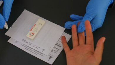 Governo busca acordo para produzir prevenção injetável de longa duração contra o HIV