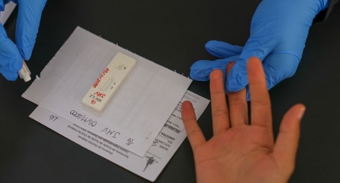 Governo busca acordo para produzir prevenção injetável de longa duração contra o HIV
