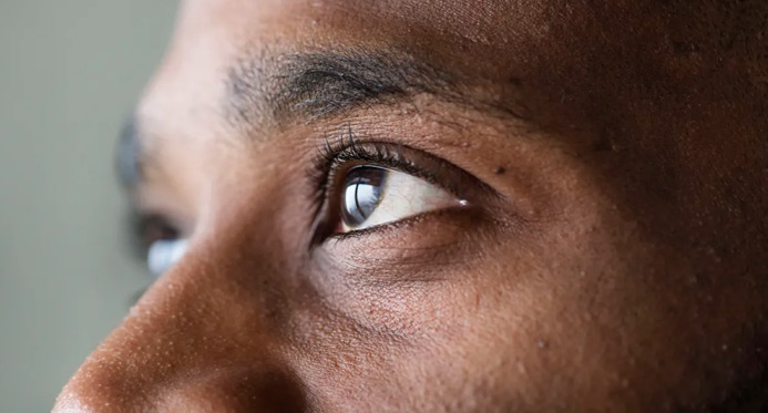 “Trend” nas redes sociais, raspar os cílios pode causar lesões nos olhos