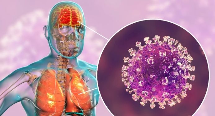 Ministério da Saúde nega casos de vírus Nipah no Brasil e descarta risco de pandemia