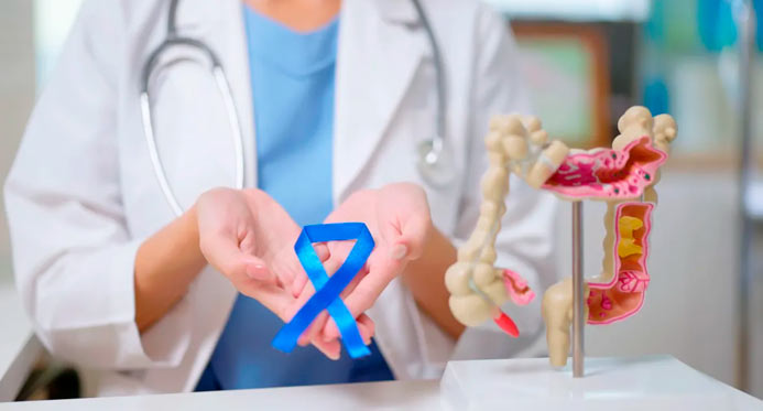 Mortes por câncer colorretal devem aumentar quase 3 vezes até 2030