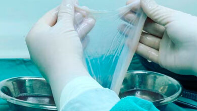 Saúde incorpora transplante da membrana amniótica para tratar diabetes