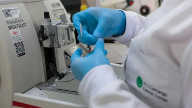 SUS inclui nova terapia para pacientes adultos com leucemia mieloide