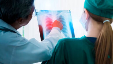 Anvisa aprova novo remédio para casos avançados de câncer de pulmão – Em Dia ES