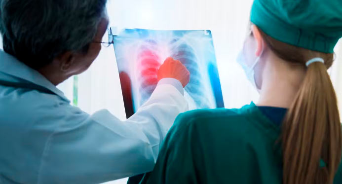Anvisa aprova novo remédio para casos avançados de câncer de pulmão – Em Dia ES