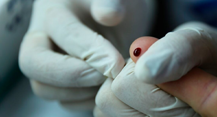 Brasil atinge meta e pede selo internacional de eliminação da hepatite B de mãe para filho – Em Dia ES