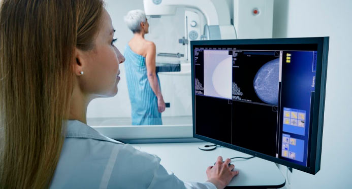 ANS amplia cobertura da mamografia digital nos planos de saúde para todas as idades – Em Dia ES