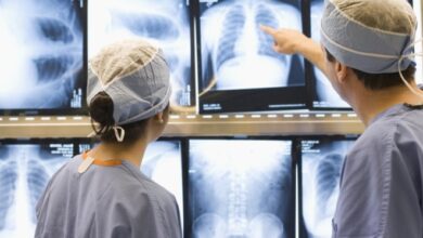 Consulta pública propõe ampliar acesso a cirurgia minimamente invasiva para câncer de pulmão no SUS – Em Dia ES