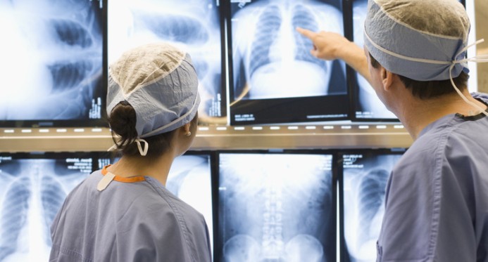 Consulta pública propõe ampliar acesso a cirurgia minimamente invasiva para câncer de pulmão no SUS – Em Dia ES